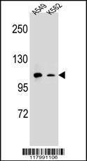 Anti-ITGAM Rabbit Polyclonal Antibody (AP (Alkaline Phosphatase))