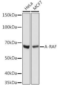 Western blot analysis of extracts of various cell lines, using Anti-A RAF Antibody [ARC1782] (A308522) at 1:1000 dilution. The secondary Antibody was Goat Anti-Rabbit IgG H&L Antibody (HRP) at 1:10000 dilution. Lysates/proteins were present at 25 µg per lane