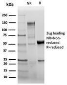 SDS-PAGE analysis of Anti-CD31 Antibody [C31/6446R] under non-reduced and reduced conditions; showing intact IgG and intact heavy and light chains, respectively. SDS-PAGE analysis confirms the integrity and purity of the antibody.