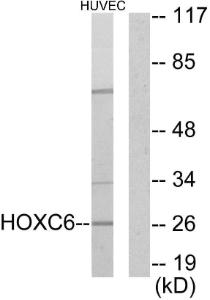 Antibody anti-HOXC6 A99077-100 100 µg