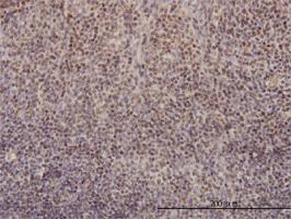 Anti-RFC4 Mouse Monoclonal Antibody [clone: 1C12]