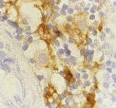 Anti-CD209 Mouse Monoclonal Antibody [clone: 8B6]