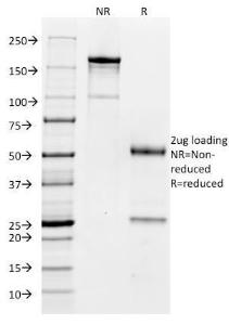 SDS-PAGE analysis of Anti-CD32 Antibody [FCGR2A/479] under non-reduced and reduced conditions; showing intact IgG and intact heavy and light chains, respectively. SDS-PAGE analysis confirms the integrity and purity of the antibody