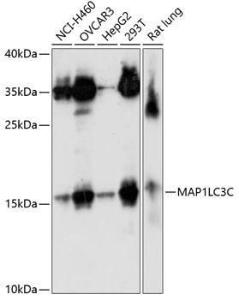 Western blot analysis of extracts of various cell lines, using Anti-LC3C Antibody (A10389) at 1:1,000 dilution The secondary antibody was Goat Anti-Rabbit IgG H&L Antibody (HRP) at 1:10,000 dilution Lysates/proteins were present at 25 µg per lane