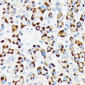 Immunohistochemistry analysis of paraffin-embedded human liver using Anti-A RAF Antibody [ARC1782] (A308522) at a dilution of 1:100 (40X lens). Perform microwave antigen retrieval with 10 mM Tris/EDTA buffer pH 9.0 before commencing with IHC staining protocol