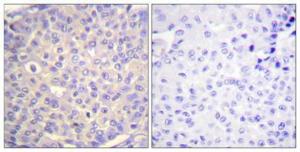 Anti-Synaptotagmin (phospho Ser309) Rabbit Polyclonal Antibody