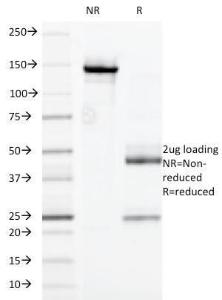 SDS-PAGE analysis of Anti-CD32 Antibody [7.3] under non-reduced and reduced conditions; showing intact IgG and intact heavy and light chains, respectively. SDS-PAGE analysis confirms the integrity and purity of the antibody.