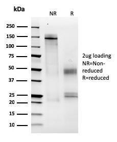 Anti-MCM6 antibody