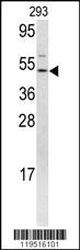 Anti-FLI1 Rabbit Polyclonal Antibody