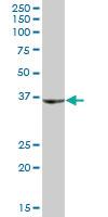 Anti-SHOX Mouse Polyclonal Antibody