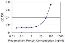 Anti-SLC22A6 Mouse Monoclonal Antibody [clone: 1F2]