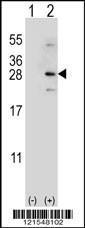 Anti-NADH Dehydrogenase Fe-S Protein 4 Rabbit Polyclonal Antibody (HRP (Horseradish Peroxidase))