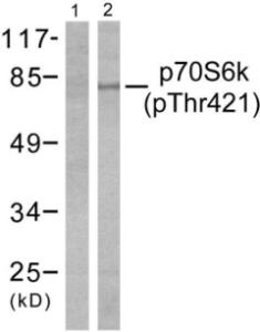 Western blot analysis of lysates from NIH/3T3 cells treated with EGF 200 ng/ml 30' using Anti-p70 S6 Kinase (phospho Thr421) Antibody. The left hand lane represents a negative control, where the antibody is blocked by the immunising peptide