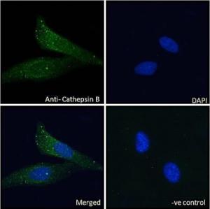 Anti-Cathepsin B Antibody (A121151) - Immunofluorescence analysis of paraformaldehyde fixed HeLa cells, permeabilized with 015% Triton Primary incubation 1hr (10 µg/ml) followed by Alexa Fluor 488 secondary antibody (2 µg/ml), showing vesicle staining