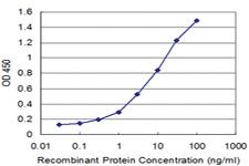 Anti-RFC4 Mouse Monoclonal Antibody [clone: 1B2]