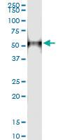 Anti-CTBS Polyclonal Antibody Pair