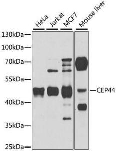 Anti-CEP44 Rabbit Polyclonal Antibody