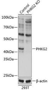 Anti-PHKG2 antibody