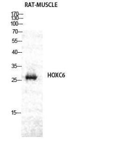 Antibody anti-HOXC6 A99077-100 100 µg