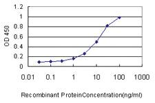 Anti-MAP3K7 Mouse Monoclonal Antibody [clone: 2E10]