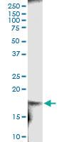 Anti-RARRES2 Polyclonal Antibody Pair