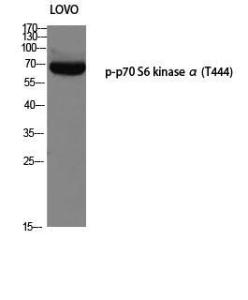 Western blot analysis of LOVO using Anti-p70 S6 Kinase (phospho Thr421) Antibody