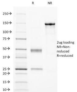 SDS-PAGE analysis of Anti-CD32 Antibody [8.7] under non-reduced and reduced conditions; showing intact IgG and intact heavy and light chains, respectively. SDS-PAGE analysis confirms the integrity and purity of the antibody.