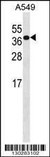 Anti-HOXD4 Rabbit Polyclonal Antibody (Biotin)