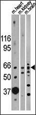 Anti-ACVR2B Rabbit Polyclonal Antibody (Biotin)