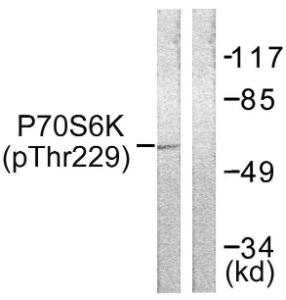 Western blot analysis of lysates from Jurkat cells using Anti-p70 S6 Kinase (phospho Thr229) Antibody. The right hand lane represents a negative control, where the antibody is blocked by the immunising peptide