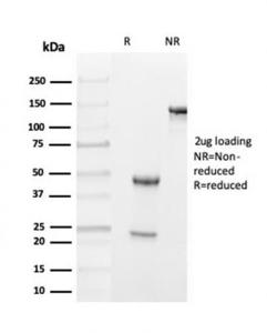 SDS-PAGE analysis of Anti-Transthyretin Antibody [TTR/4293] under non-reduced and reduced conditions; showing intact IgG and intact heavy and light chains, respectively. SDS-PAGE analysis confirms the integrity and purity of the antibody