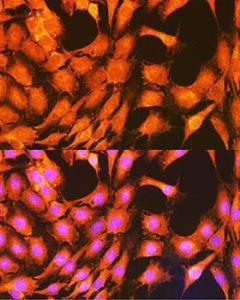 Anti-PHKG2 antibody