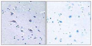 Immunohistochemical analysis of paraffin-embedded human brain using Anti-p70 S6 Kinase (phospho Thr229) Antibody. The right hand panel represents a negative control, where the antibody was pre-incubated with the immunising peptide