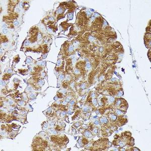 Anti-PNLIPRP1 antibody