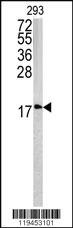 Anti-UXS1 Rabbit Polyclonal Antibody