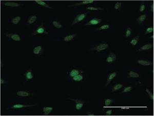 Anti-RFC5 Mouse Monoclonal Antibody [clone: 1B1]