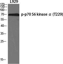 Western blot analysis of various cells using Anti-p70 S6 Kinase (phospho Thr229) Antibody