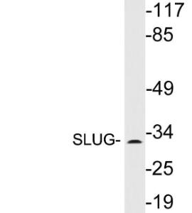 Western blot analysis of lysates from HepG2 cells using Anti-SLUG Antibody