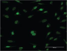 Anti-RFC5 Mouse Monoclonal Antibody [clone: 1B1]