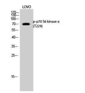 Western blot analysis of LOVO cells using Anti-p70 S6 Kinase (phospho Thr229) Antibody