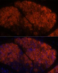 Anti-PNLIPRP1 antibody