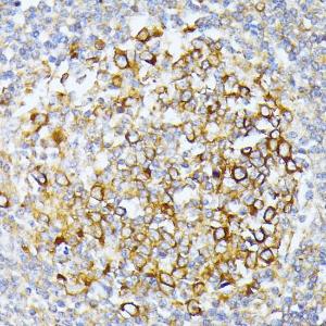 Immunohistochemistry analysis of paraffin-embedded human tonsil using Anti-CAD/BM1 Antibody (A10396) at a dilution of 1:100 (40x lens) Perform microwave antigen retrieval with 10 mM PBS buffer pH 72 before commencing with IHC staining protocol