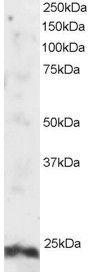 Anti-ARL4A antibody