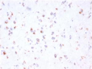 Immunohistochemical analysis of formalin-fixed, paraffin-embedded human cerebellum using Anti-FCGRT Antibody [FCGRT/2932]