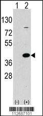 Anti-EPM2A Rabbit Polyclonal Antibody