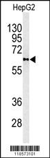 Anti-PLTP Rabbit Polyclonal Antibody