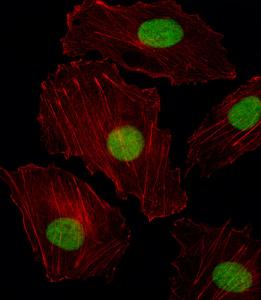 Anti-ISL2 Rabbit Polyclonal Antibody (FITC (Fluorescein Isothiocyanate))