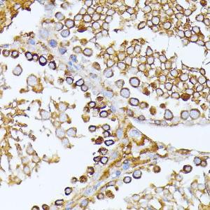 Immunohistochemistry analysis of paraffin-embedded rat testis using Anti-CAD/BM1 Antibody (A10396) at a dilution of 1:100 (40x lens) Perform microwave antigen retrieval with 10 mM PBS buffer pH 72 before commencing with IHC staining protocol