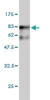 Anti-SARS Mouse Monoclonal Antibody [clone: 1H4]