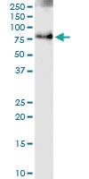 Anti-IFNGR1 Polyclonal Antibody Pair